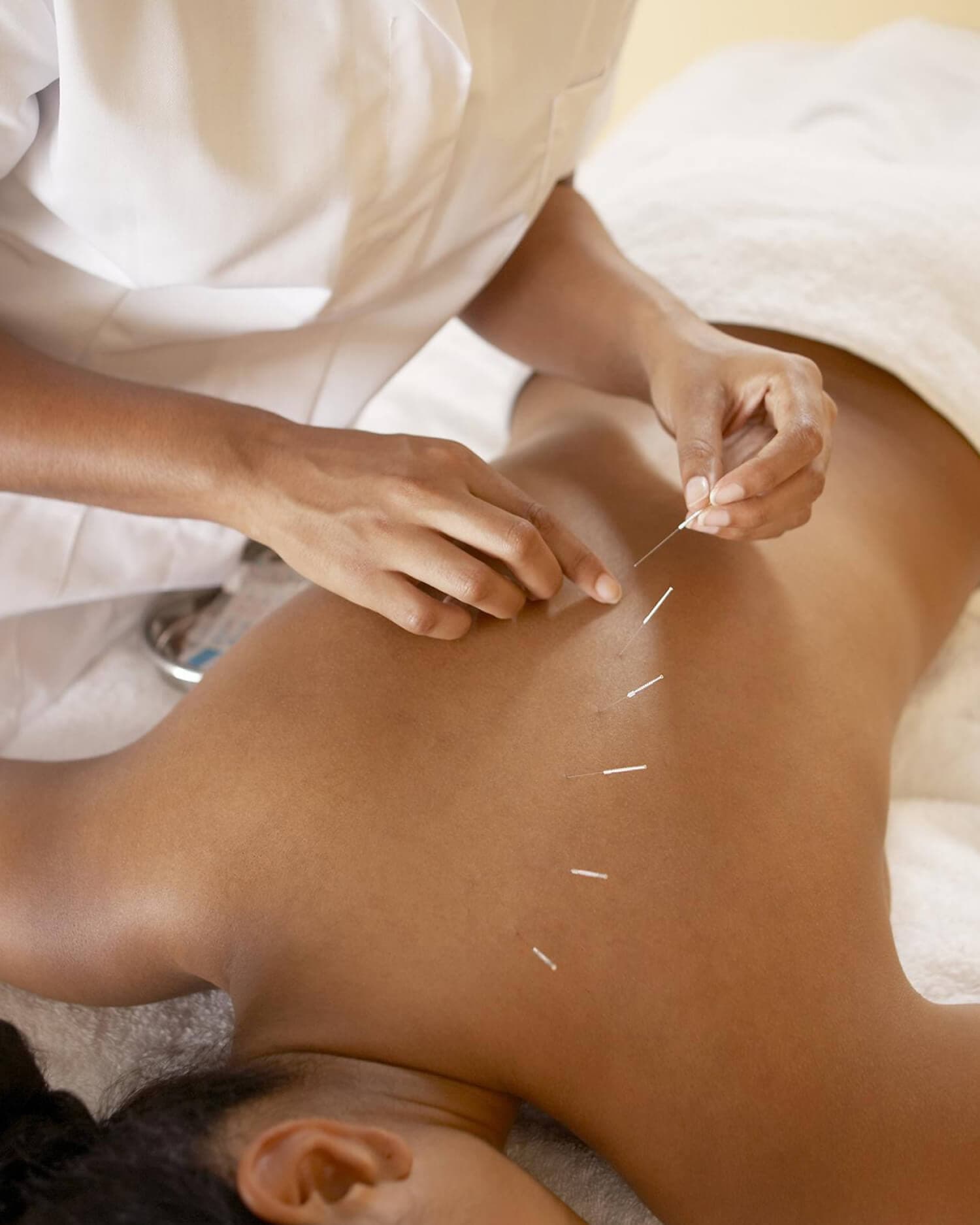 Acupuncture-Massage_1500x1875